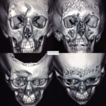 collage of four face x ray images