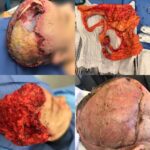 collage of head surgery pictures